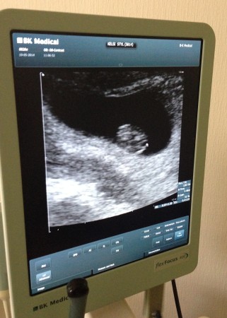 ultrasound